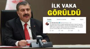 Maymun çiçeği virüsü Türkiye'de görüldü